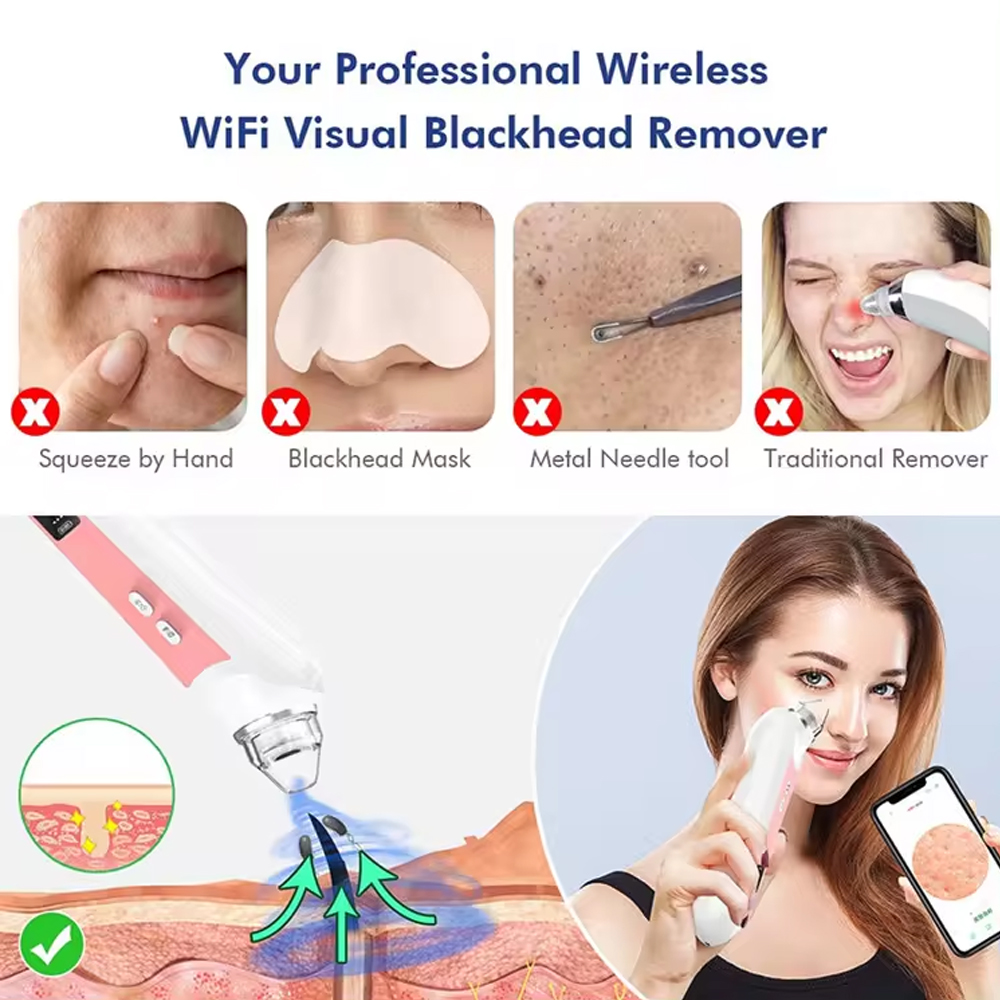 6 głowic do oczyszczania porów – Nasal Aspirator recenzja i cena